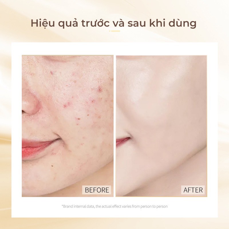 [Chính Hãng] Mặt nạ ngủ thạch collagen tươi Bioaqua hộp 20 gói nâng cơ dưỡng da săn chắc mỹ phẩm nội địa Trung