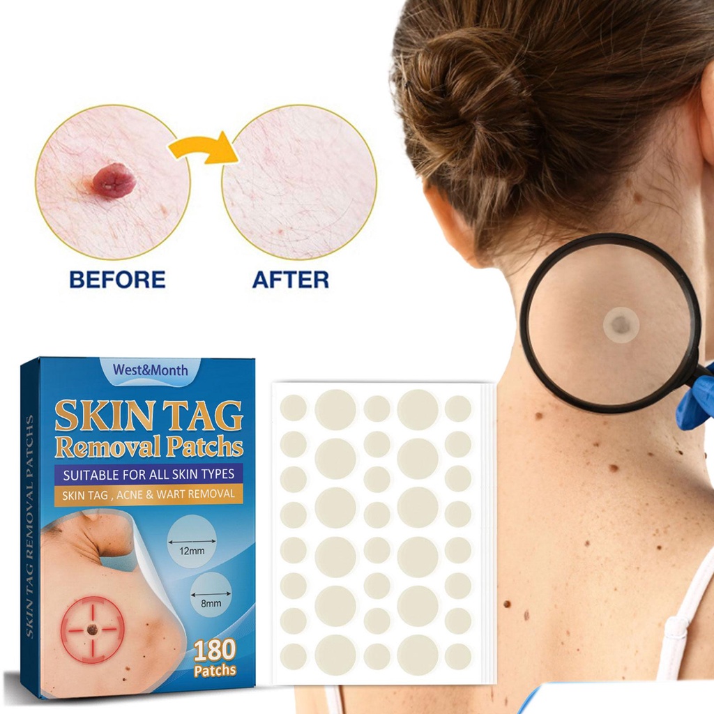 Hộp 180 Miếng Dán Hỗ Trợ Giảm Mụn Tinh Chất Hydrocolloid / Mụn Trứng Cá / Mụn Nhọt Vô Hình