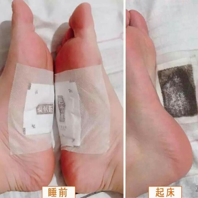 Set miếng dán chân (hoa ải & gừng già) | BigBuy360 - bigbuy360.vn