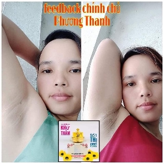 siêu dưỡng thâm 5s Biho ladi