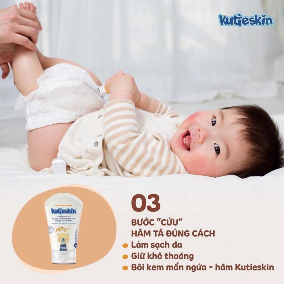 Kem bôi dịu da cho bé KUTIESKIN, mẩn ngứa 30gr giành cho da bé sơ sinh và trẻ nhỏ bị rôm sảy muỗi đốt côn trùng cắn