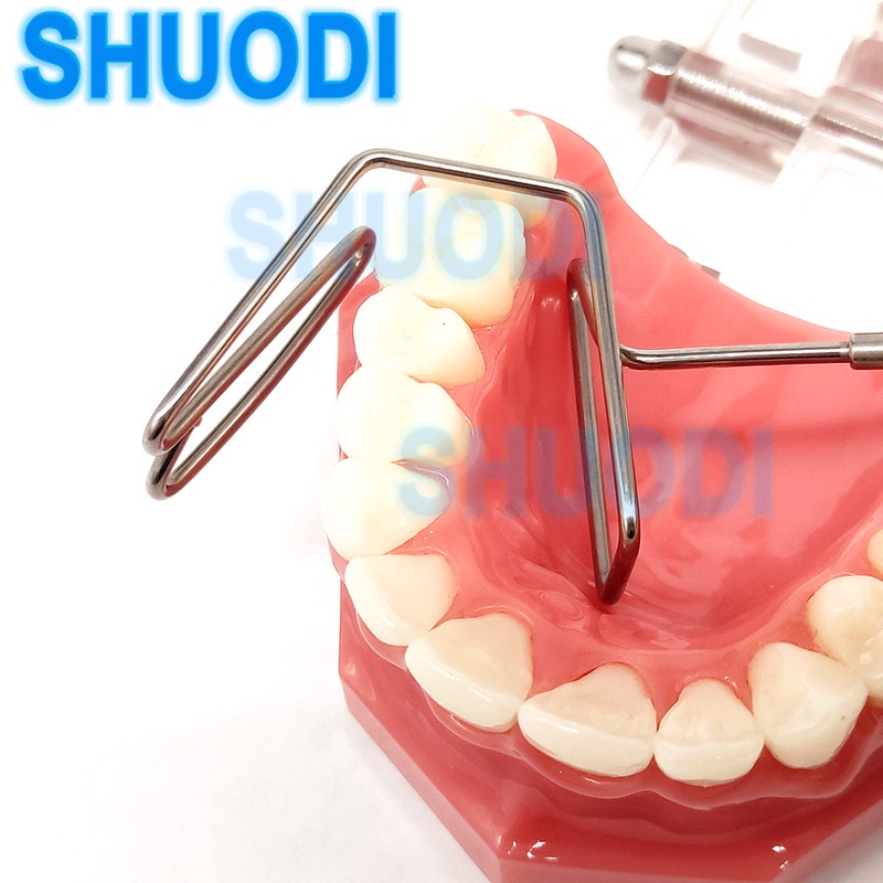 Dụng Cụ Tách Đôi Môi Bằng Thép Không Gỉ