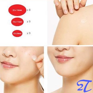 Dán Mụn Cao Cấp COSRX AC Collection Acne Patch 26 miếng