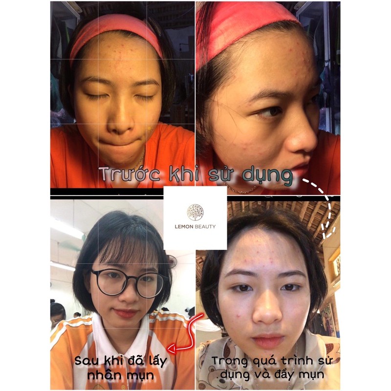 [CHÍNH HÃNG] LEMON MASK - Mặt Nạ Khổ Qua Rừng, Tảo Biển, Sữa Dê Non Handmade | BigBuy360 - bigbuy360.vn