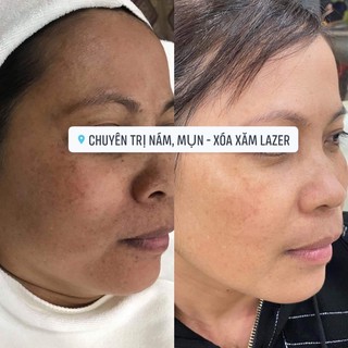 KEM DƯỠNG ẨM YANZHIXIU số 3
