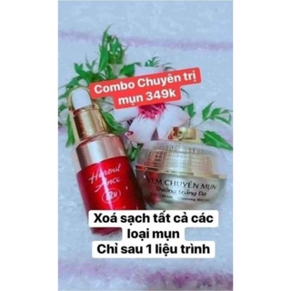 Combo mụn nhà huỳnh đỗ kèm quà tặng