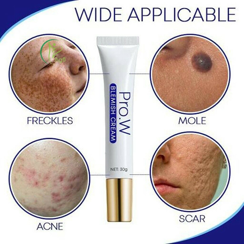 HYP Pro.W Blemish Cream Freckles Acne Pimple Scar Dark Spots Removal Skin Whitening Brightening @VN