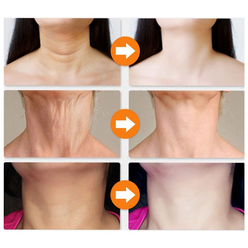 Kem Dưỡng Da Mặt Và Cổ Làm Trắng Ngừa Nếp Nhăn Và Lão Hóa Hiệu Quả 30g