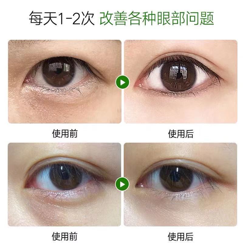 60 cái Mặt nạ mắt Tinh chất trái cây Chống lão hóa Mặt nạ mắt Chống nếp nhăn Làm mờ quầng thâm Túi mắt Dưỡng ẩm | BigBuy360 - bigbuy360.vn