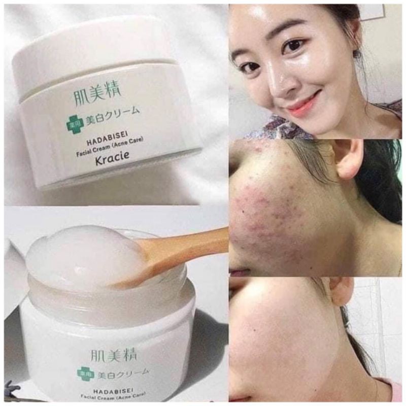 Kem Dưỡng Ngừa Mụn Kracie Nhật Bản Hadabisei Facial Cream 50g Dưỡng Trắng Da Dành Cho Da Dầu Mụn