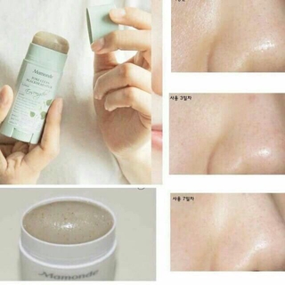 THANH LĂN MỤN ĐẦU ĐEN MAMONDE