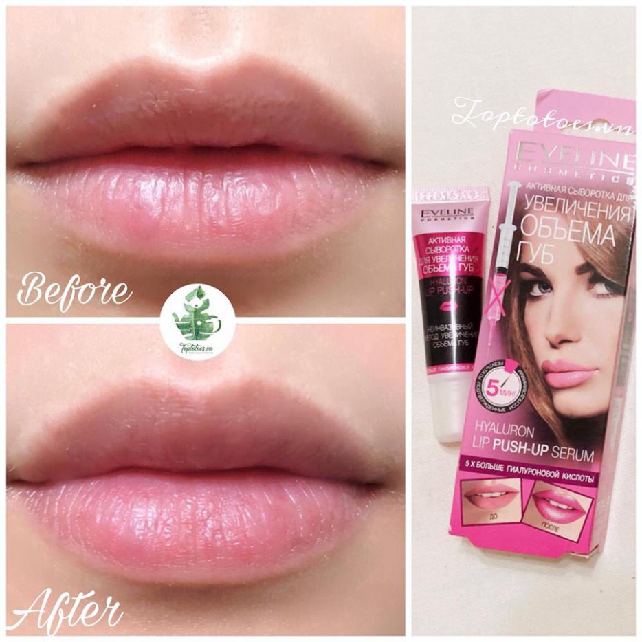 Serum dưỡng môi Eveline Hyaluron Lip Push-up làm môi căng hồng, mềm ẩm