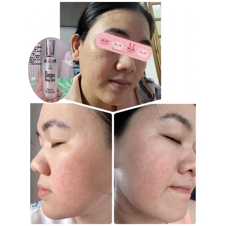 Detox Hồng Sâm drcell hổ trợ thải độc, dưỡng ẩm, chống lão hóa cho da chai 50ml - SAN39