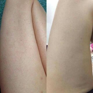 Bột tắm Linhcen