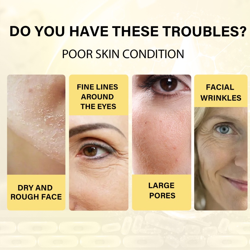 Tinh Chất Vàng Protein Collagen Dưỡng Ẩm Chống Lão Hóa Và Nếp Nhăn Cho Da Mặt