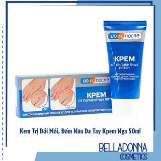 Kem Hỗ Trợ Giảm Đồi Mồi, Đốm Nâu Da Tay Kpem Nga 50ml