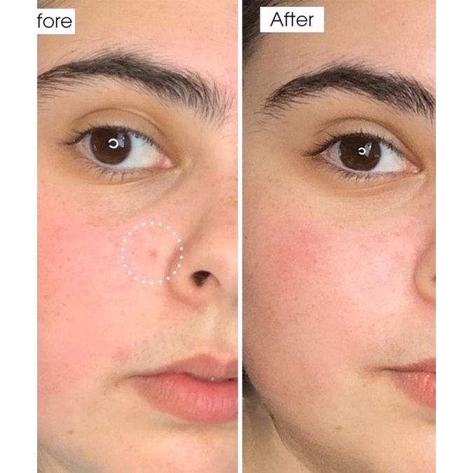SERUM NEOGEN 22% VITAMIN C SÁNG DA MỜ THÂM