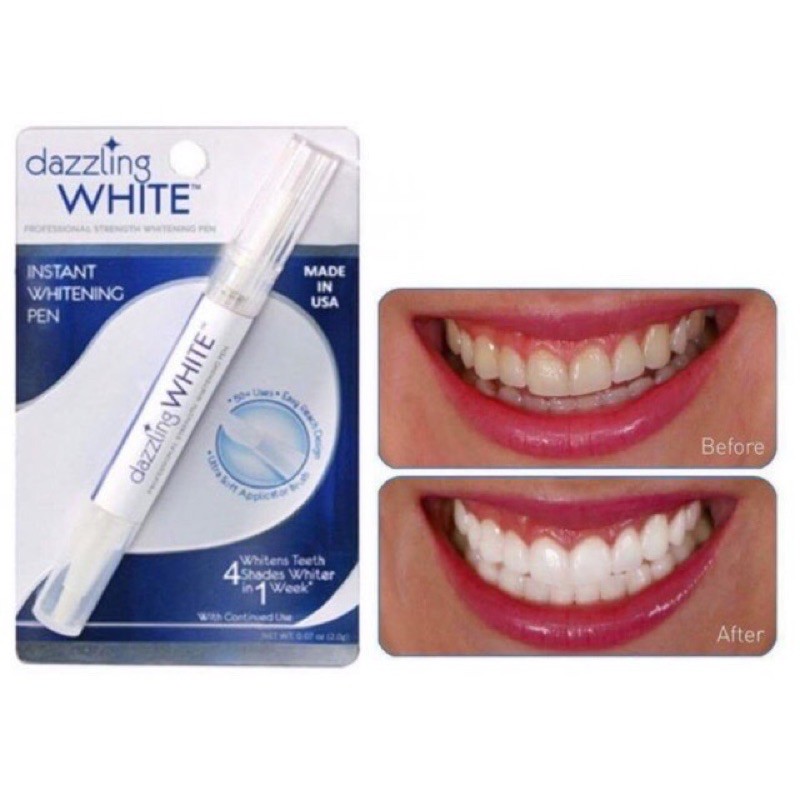 Bút tẩy trắng răng Dazzling White giúp răng trắng sáng hiệu quả