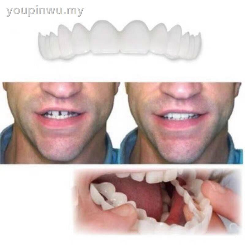 (Hàng Mới Về) Vỏ Bọc Răng Giả Làm Trắng Phục Hồi Và Phục Hồi Răng