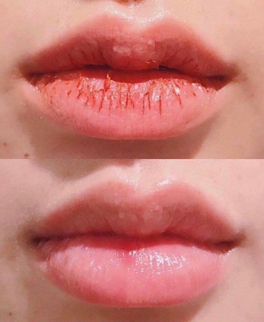 Tẩy da chết môi Bubi Bubi Lip, Tẩy tế bào chết cho môi Bubi Lip | BigBuy360 - bigbuy360.vn