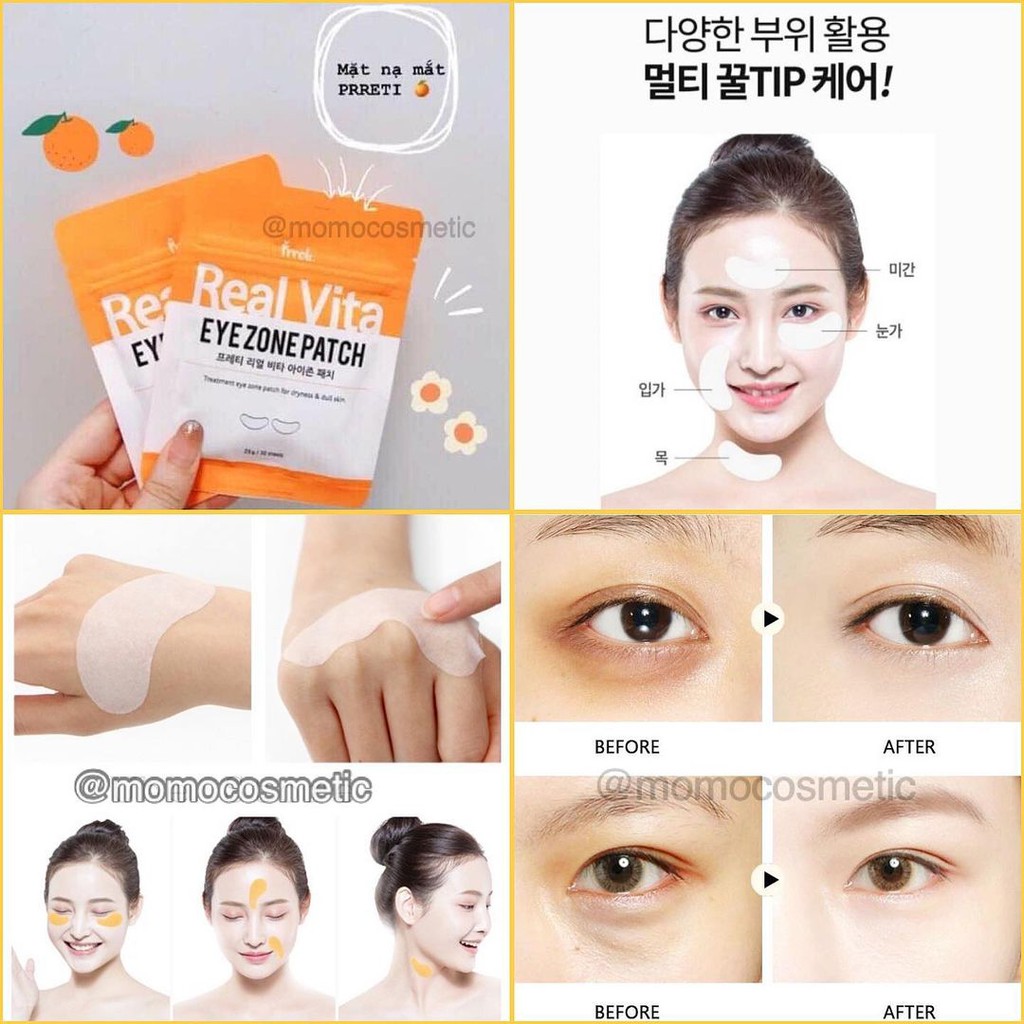 [Mã SKAMLTSM9 giảm 10% đơn 99K] Mặt nạ mắt Prreti Real Vita Eyezone Patch