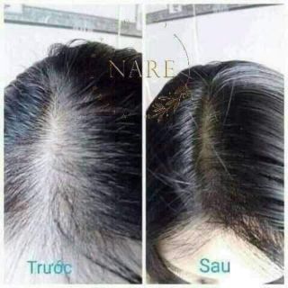 Tinh dầu bưởi Nare