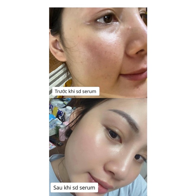 Serum tái tạo làn da Skin Fuel | BigBuy360 - bigbuy360.vn