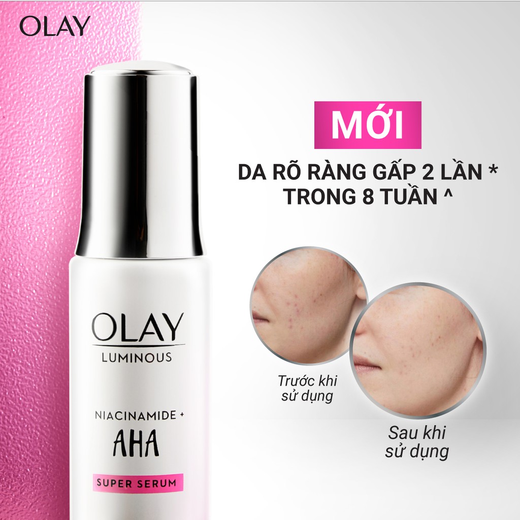 Serum/Tinh Chất Dưỡng Sáng Da, Mờ Thâm Mụn OLAY LUMINOUS NIACINAMIDE AHA 30ML