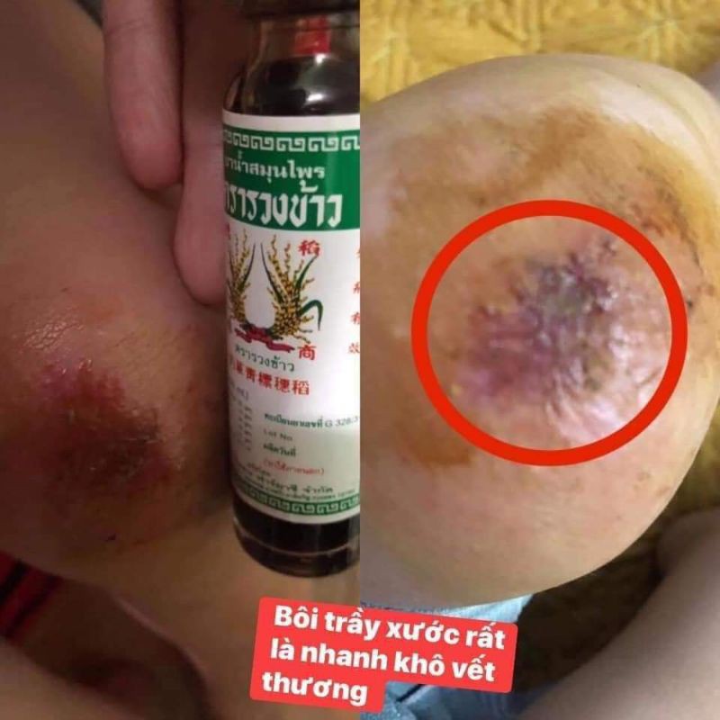 Dầu Bông Lúa MINYAK Thái Lan