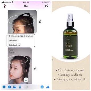 [Kèm Quà Tặng] Combo 5 chai tinh dầu bưởi giảm rụng tóc , mọc tóc Vi Jully