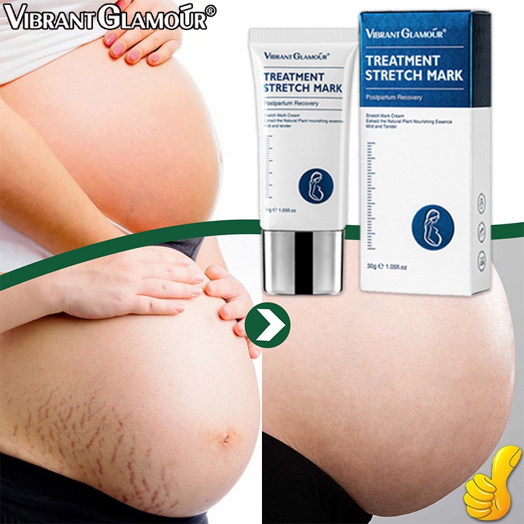 Kem Rạn da - Giảm Rạn Da vung Bụng Đùi sau sinh - Da Dầu rạn da Serum giảm rạn da Tinh dầu rạn da - 30g