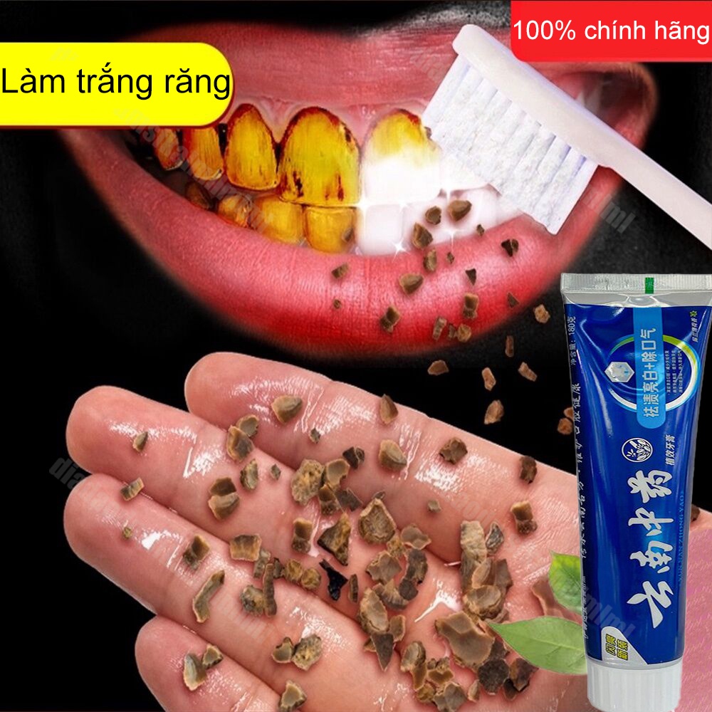 Kem đánh răng làm trắng răng loại bỏ ố vàng răng loại bỏ mảng bám trên răng khử mùi hôi miệng vệ sinh răng miệng cao răn