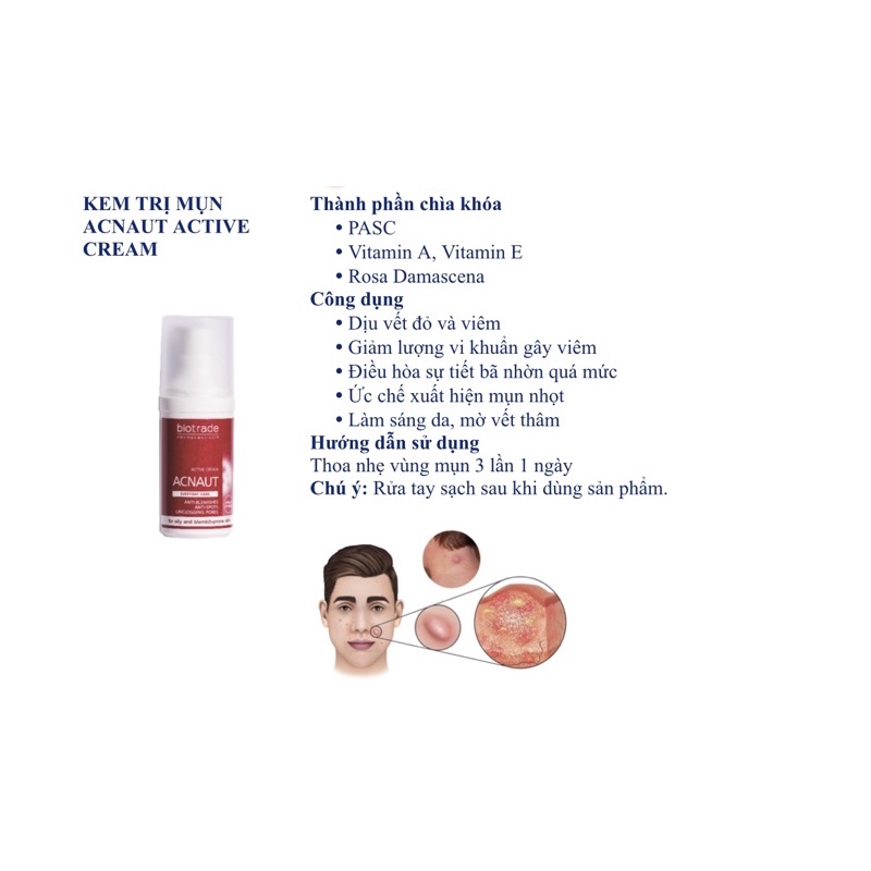 Kem Chấm Mụn - Active Cream 30ml