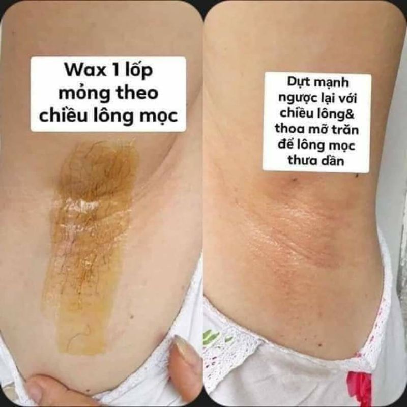 Combo wax lạnh  kèm serum mỡ trăn cao cấp