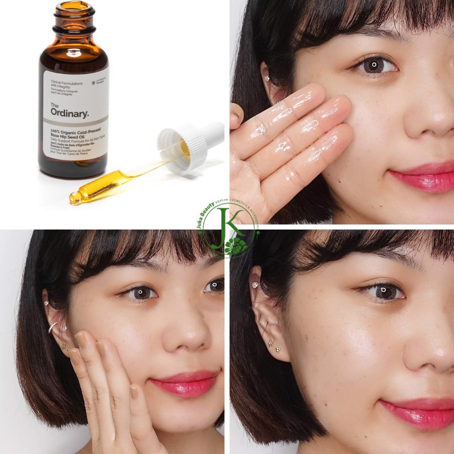 The Ordinary 100% Organic Cold Pressed Rose Hip Seed Oil. , dưỡng sáng, dưỡng lành vết thương do mụn | BigBuy360 - bigbuy360.vn