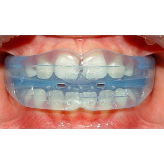 Hàm trainer chỉnh nha
