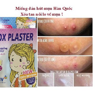 Miếng dán hút mụn Hàn Quốc