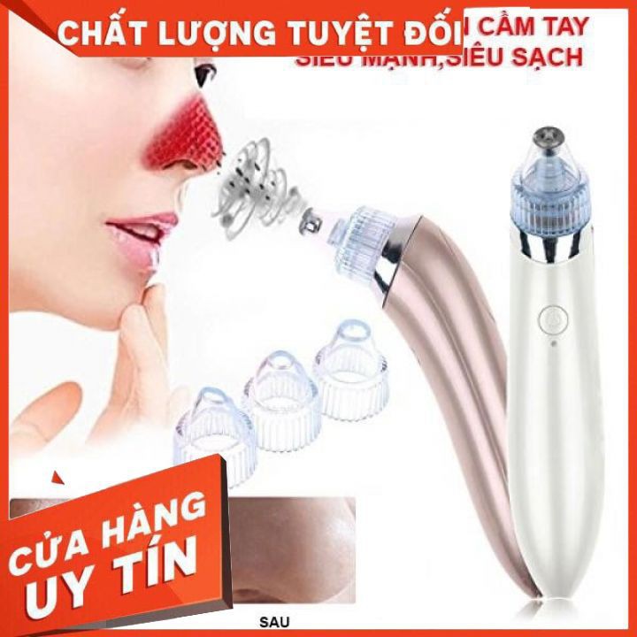 Máy Hút Mụn Hàn Quốc Cao Cấp + Tặng 4 Đầu Hút