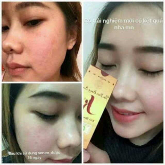 Thảo dược hoàng cung serum Kiều