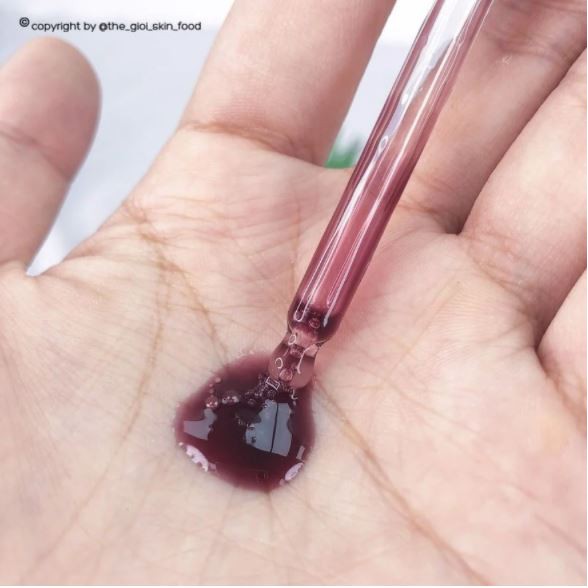 Tinh Chất Tẩy Da Chết Hóa Học So' Natural Red Peel Tingle Serum 35ml | BigBuy360 - bigbuy360.vn
