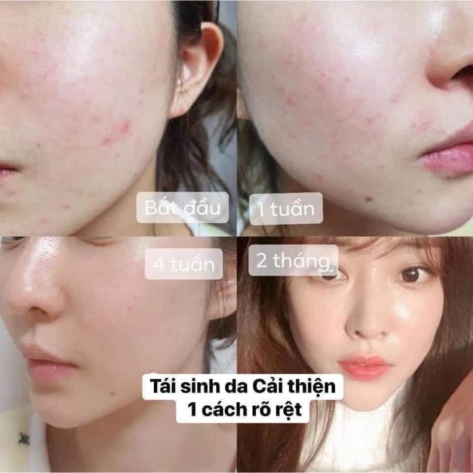 Nước Hoa Hồng  Medipeel, Toner Medipeel  Dưỡng Trắng  GentsOfficialStore