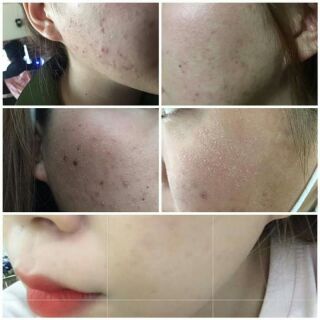 Kem Meiduzi Nhật Bản