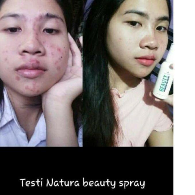 ! Tấm trải giường phun sương làm đẹp mã-288 Natura thế giới 10 | BigBuy360 - bigbuy360.vn