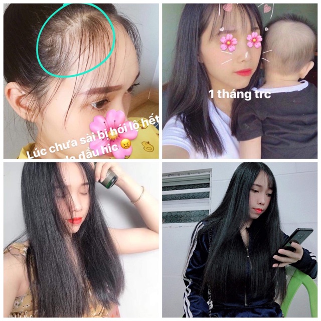 Tinh dầu bưởi trị rụng tóc-kích mọc tóc-dưỡng tóc | BigBuy360 - bigbuy360.vn