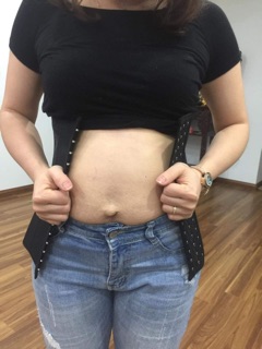 Gen Nịt bụng Latex