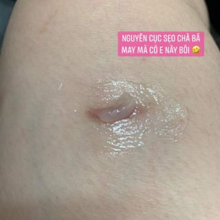 Kem  trị sẹo nhật