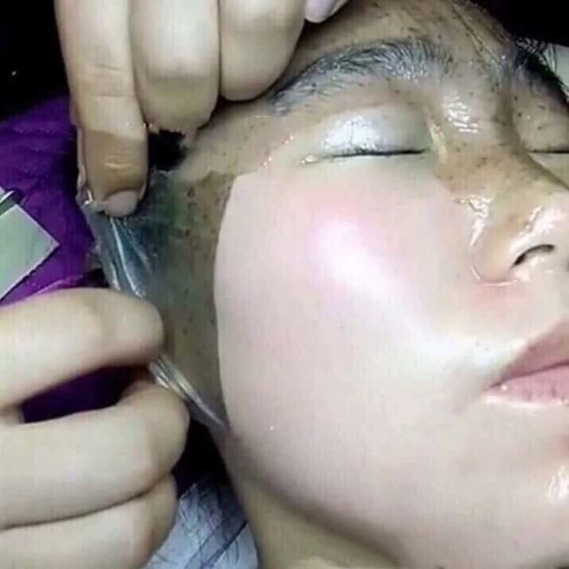 Mặt Nạ Màng Tế Bào Gốc Trắng Da Xóa Nám GoGo