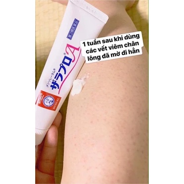 Kem loại bỏ viêm nang lông Zaraporo Rohto Nhật Bản hết viêm lỗ chân lông viêm á sừng