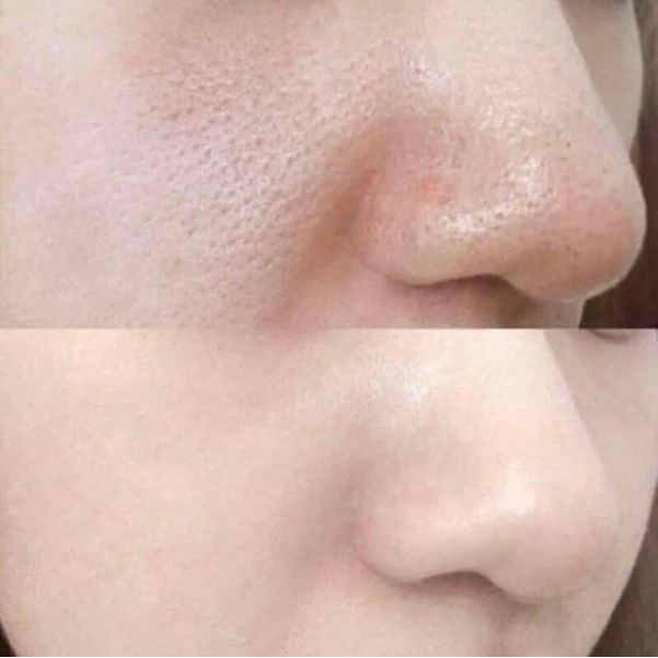 Kem Dưỡng Da Bioderma SEBIUM PORE REFINER Thu Nhỏ Lỗ Chân Lông - 30ml