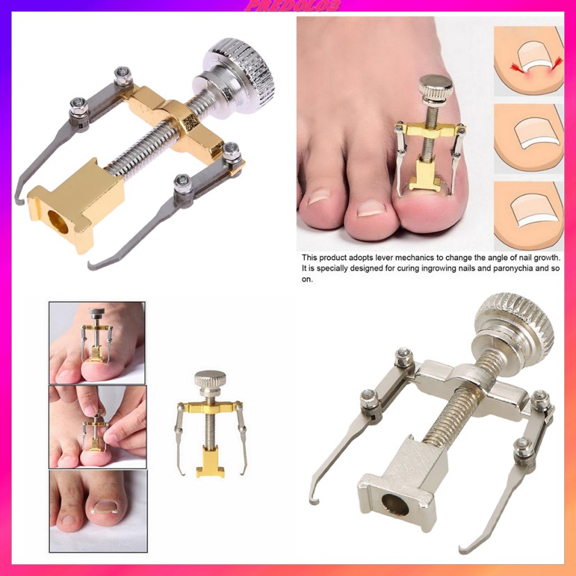 2 Dụng Cụ Chỉnh Hình Móng Chân Mọc Ngược